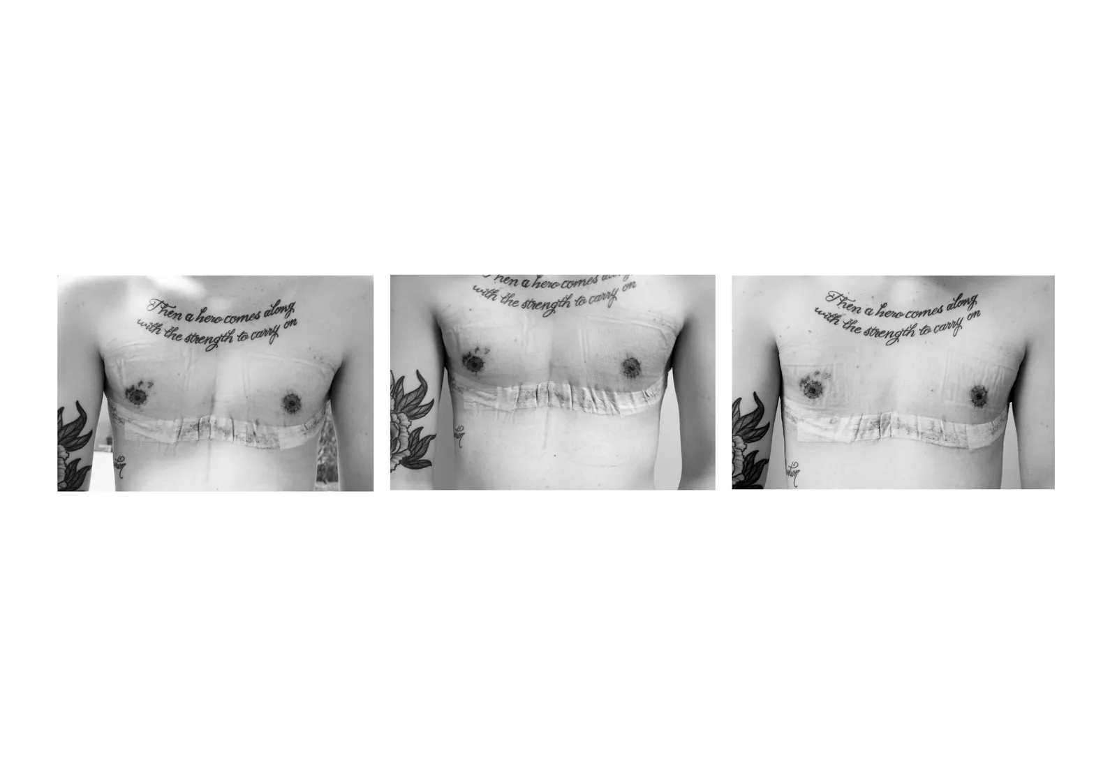 A triptych of black and white photographs showing a person's chest after surgery, with tattoos visible.